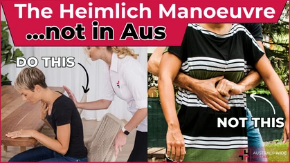 In American film and television, the Heimlich manoeuvre is typically touted as the best way to treat choking victims. However, its name recognition defies its relatively ineffective and sometimes life-threatening impact on choking casualties. 